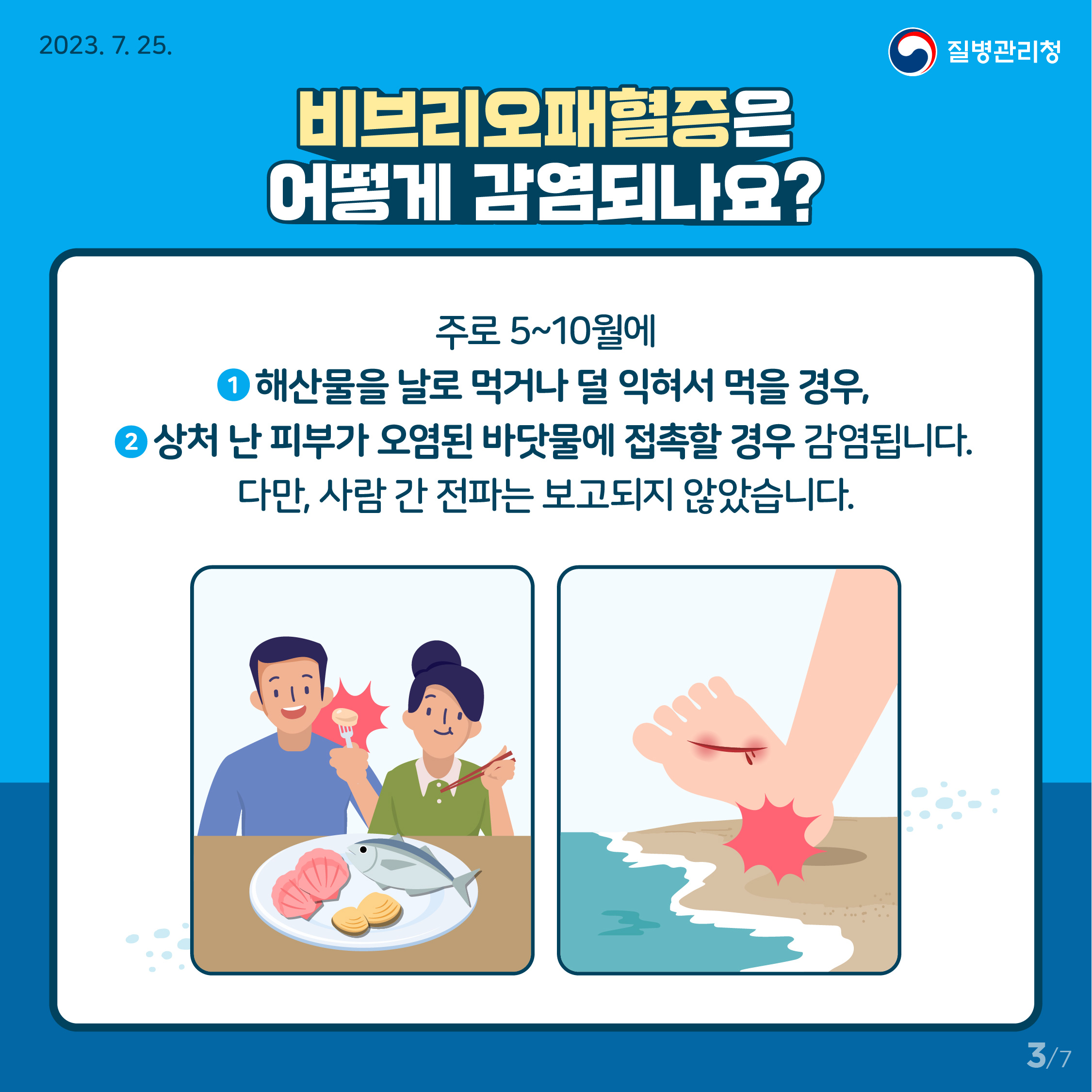 비브리오패혈증 발생 증가, 고위험군 주의 필요! 이미지 3