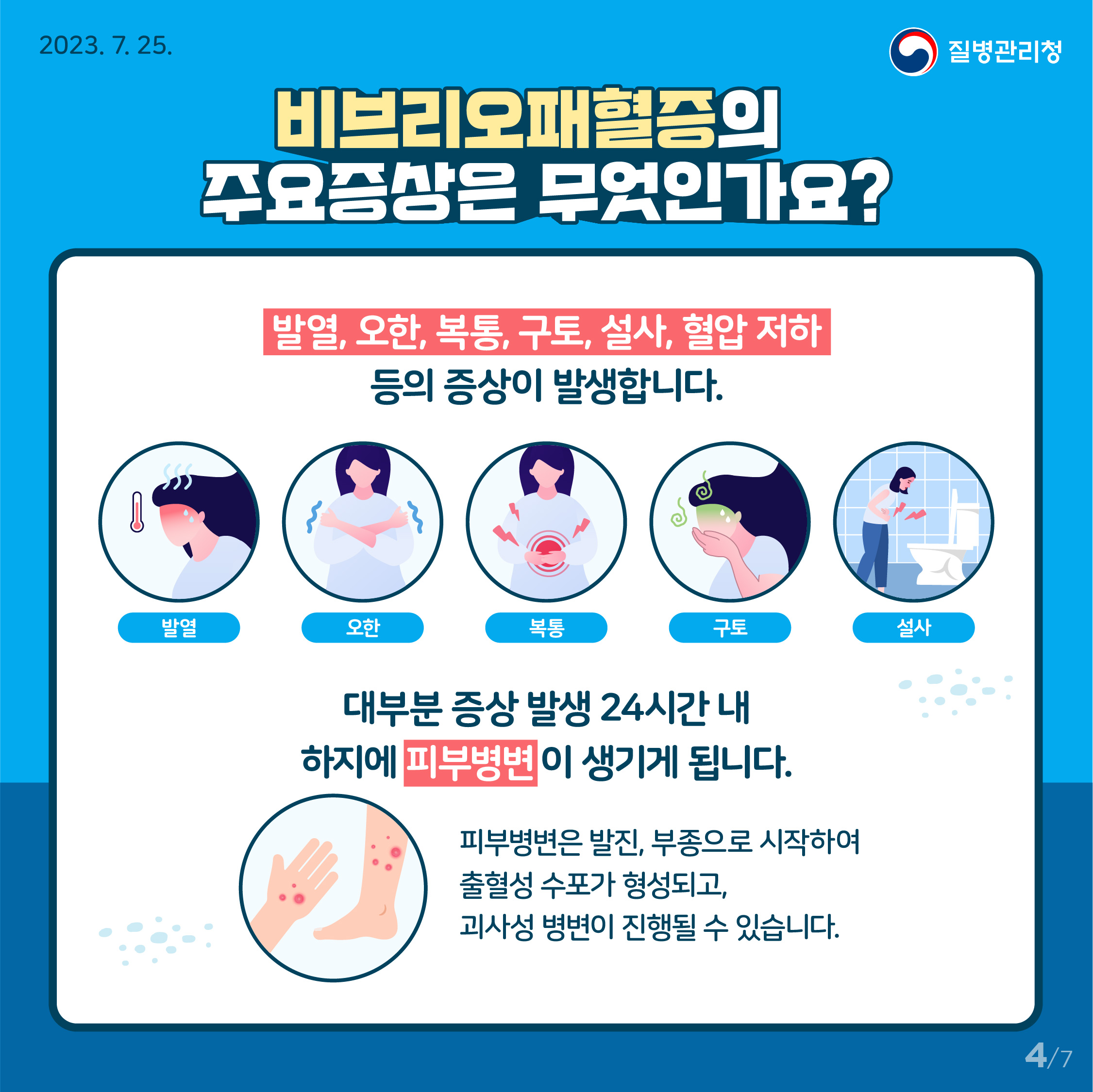 비브리오패혈증 발생 증가, 고위험군 주의 필요! 이미지 4